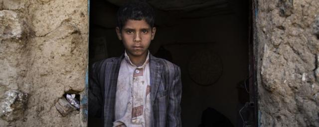 Yahya* vit dans une seule pièce avec sa famille et tout ce qu'ils possèdent. Ils doivent marcher plus de deux heures pour atteindre les puits d'eau, qui sont souvent contaminés par le choléra. Photo: Gabreez/Oxfam